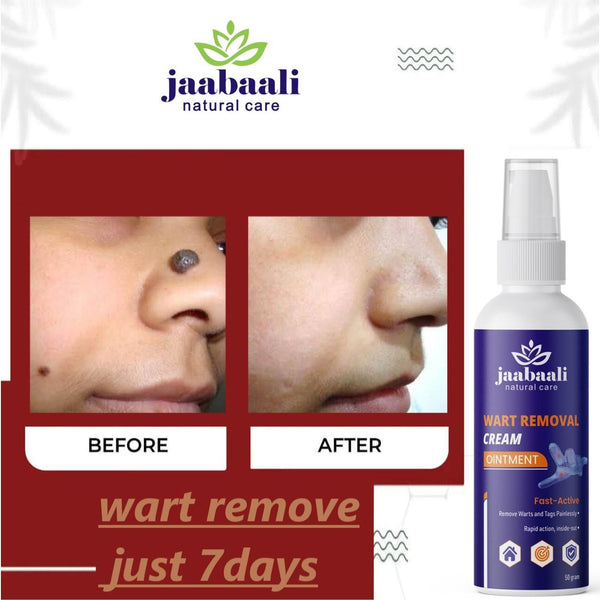 Wart Remover Cream piqnsv-2x